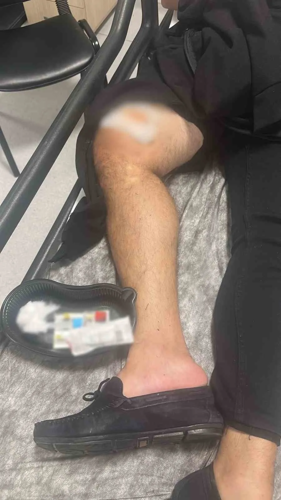 Muğla’nın Marmaris ilçesinde meydana gelen silahlı kavgada bir kişi bacağından