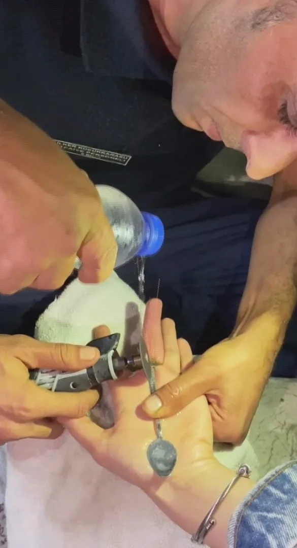 Hatay’ın Kırıkhan ilçesinde parmağına sıkışan yüzük, itfaiye ekiplerinin müdahalesiyle çıkartıldı.