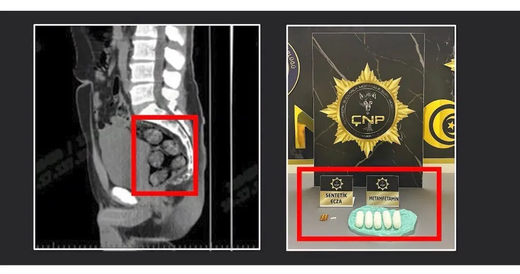 İran’dan Çanakkale’ye midesine yutarak sakladığı uyuşturucularla satış için gelen zehir