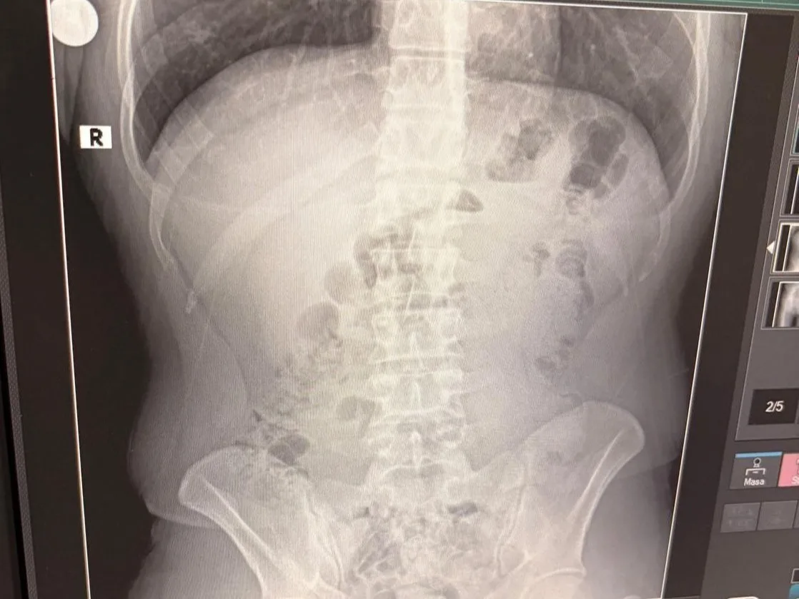 Uşak’ta uyuşturucu ticareti yaptıkları iddiasıyla yakalanan İran uyruklu 3 şahsın