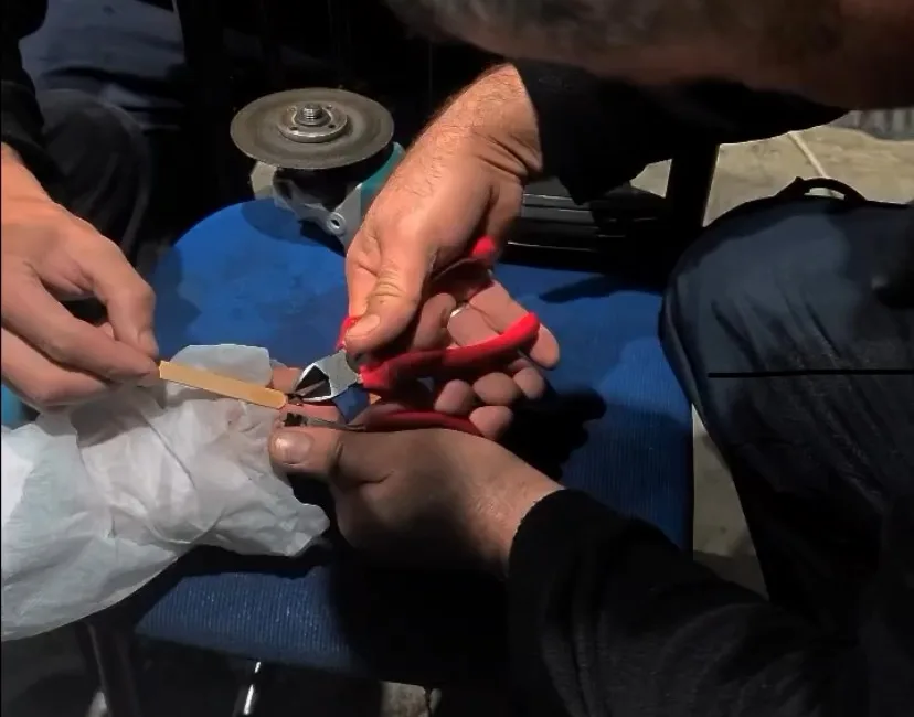 Çankırı’da bir vatandaşın parmağına sıkışan yüzük, itfaiye ekipleri tarafından kesilerek