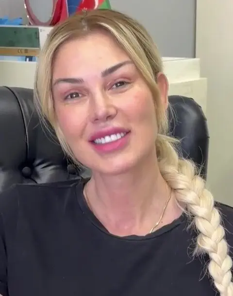 Ünlü sanatçı Petek Dinççöz’ün 8 ay önce geçirdiği estetik operasyon