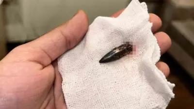 İsrail ordusunun Gazze Şeridi’ne yönelik saldırılarında başından vurulan küçük Awad,