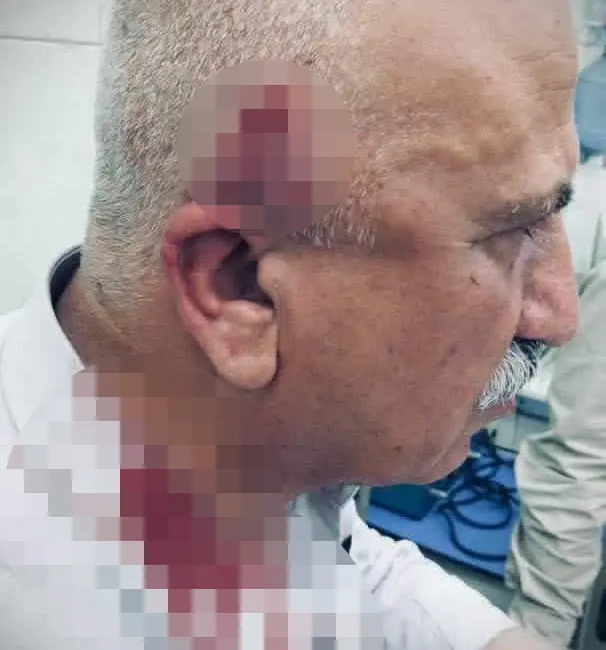 Irak’ın Kerkük kentindeki Haziran semtinde kaçak yapılarla mücadele çalışmaları kapsamında