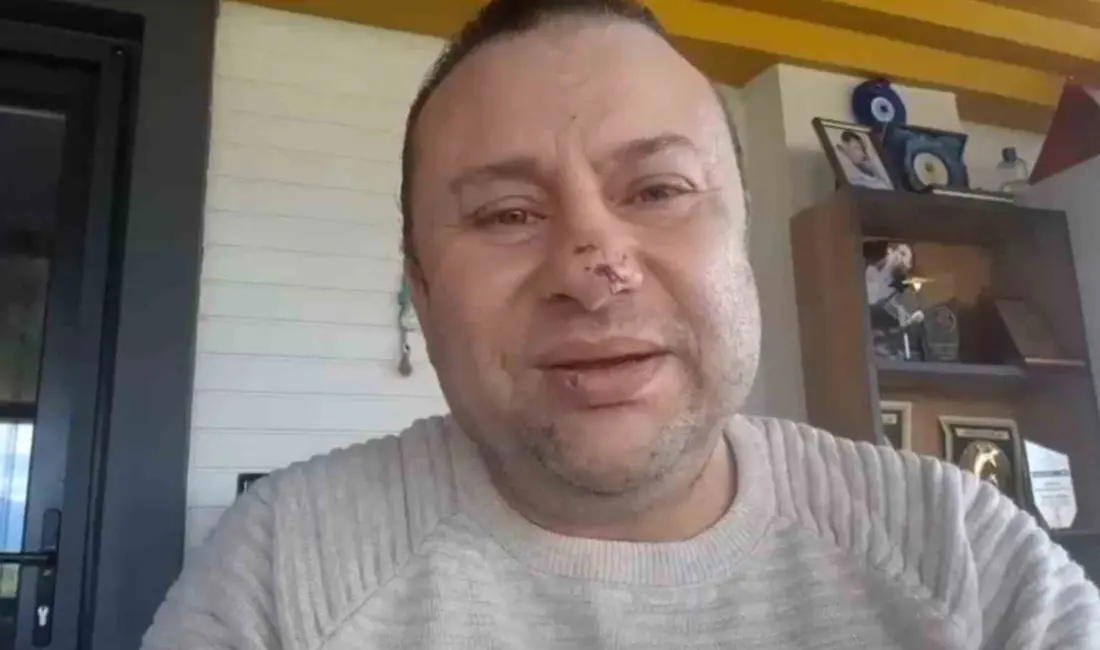 Balıkesir Akçay’da köpeğini gezdirdiği sırada pitbull cinsi köpeğin saldırısına uğrayan