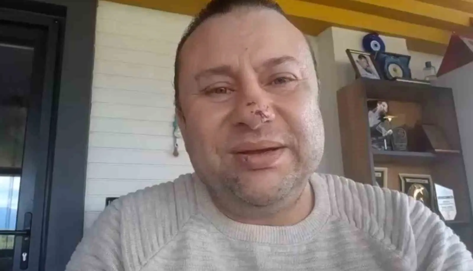 Balıkesir Akçay’da köpeğini gezdirdiği sırada pitbull cinsi köpeğin saldırısına uğrayan