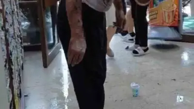 Bursa’da bir işhanında tıkanan lavabo giderini açmak için dökülen güçlü