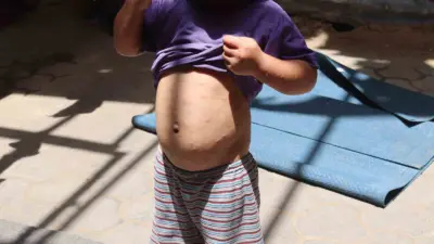 İsrail ablukası altındaki Gazze Şeridi’nde temiz su eksikliği ve yetersiz