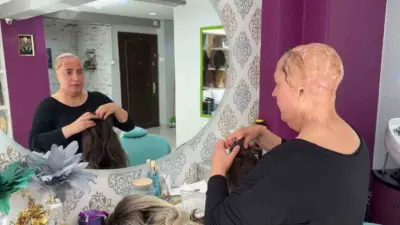 Küçük yaşta geçirdiği feci iş kazasında saçlarını ve kulaklarını kaybeden